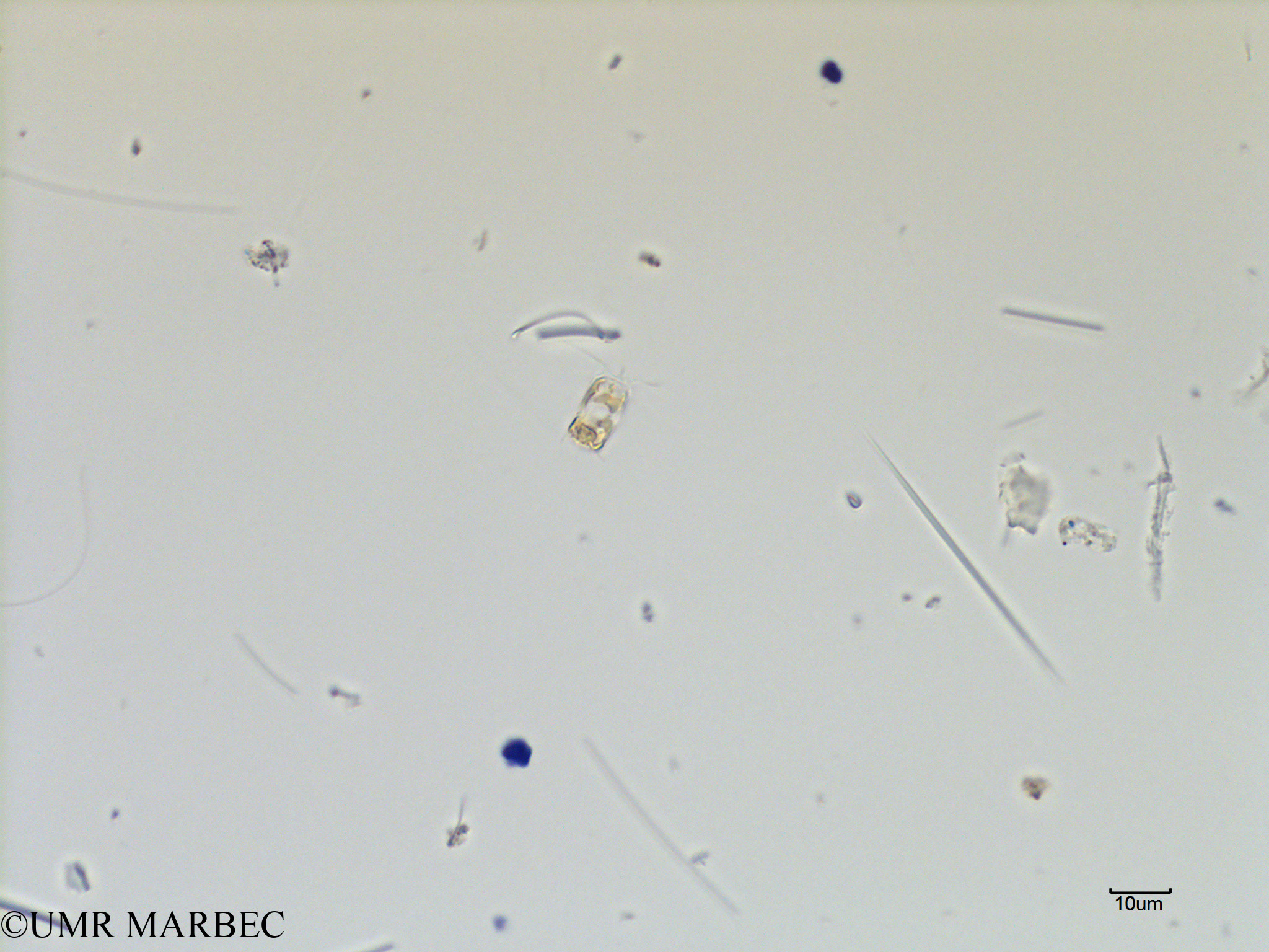 phyto/Scattered_Islands/mayotte_lagoon/SIREME May 2016/Bacteriastrum sp10 (ancien B. sp2 -MAY5_bacteriastrum b).tif(copy).jpg